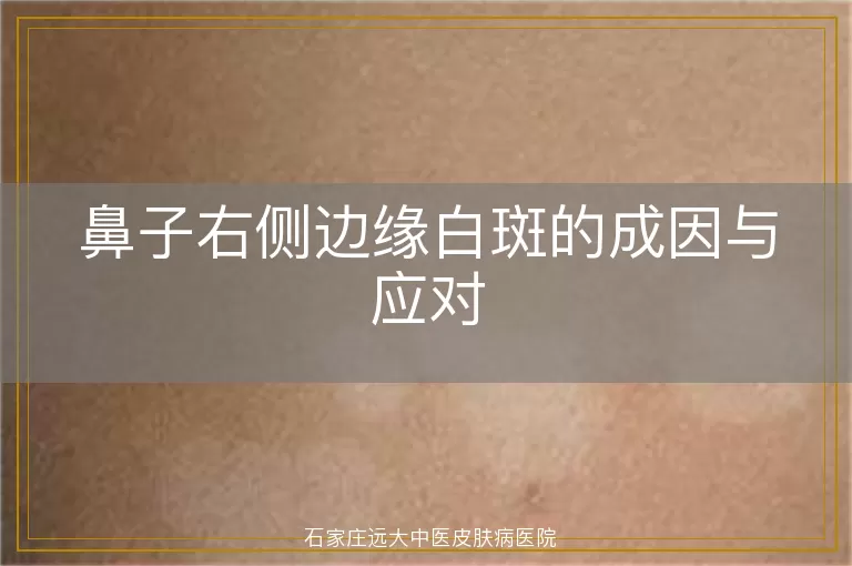 鼻子右侧边缘白斑的成因与应对