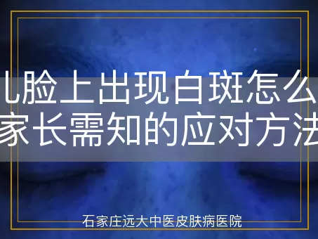 婴儿脸上出现白斑怎么办？家长需知的应对方法