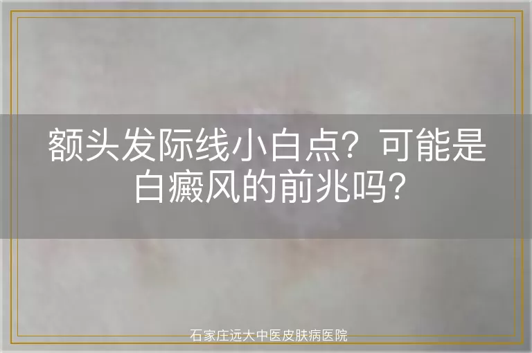 额头发际线小白点？可能是白癜风的前兆吗？