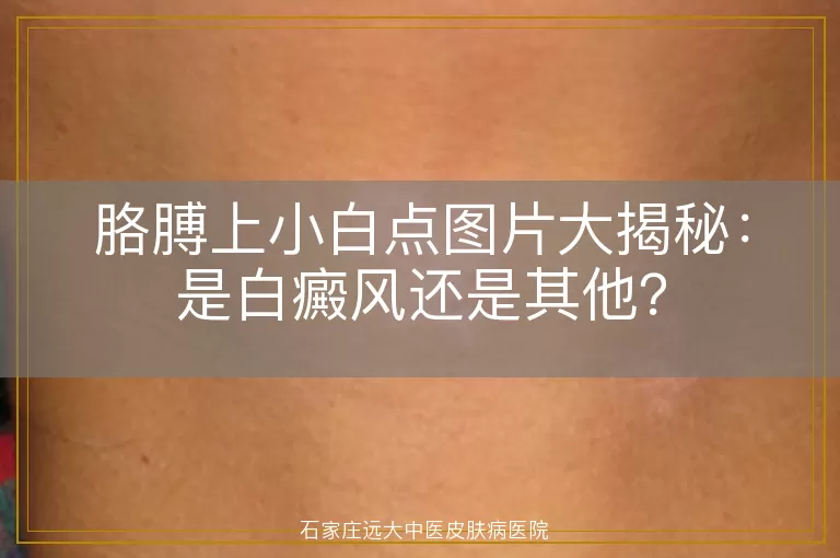 胳膊上小白点图片大揭秘：是白癜风还是其他？