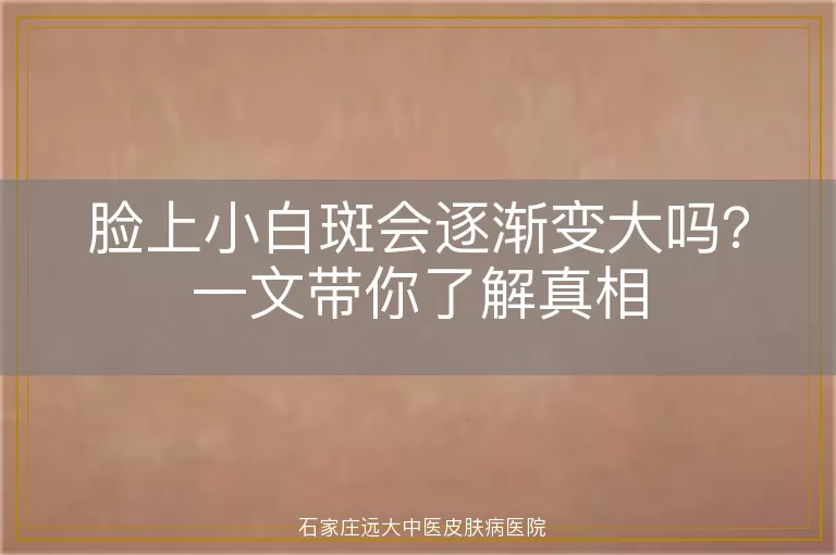 脸上小白斑会逐渐变大吗？一文带你了解真相