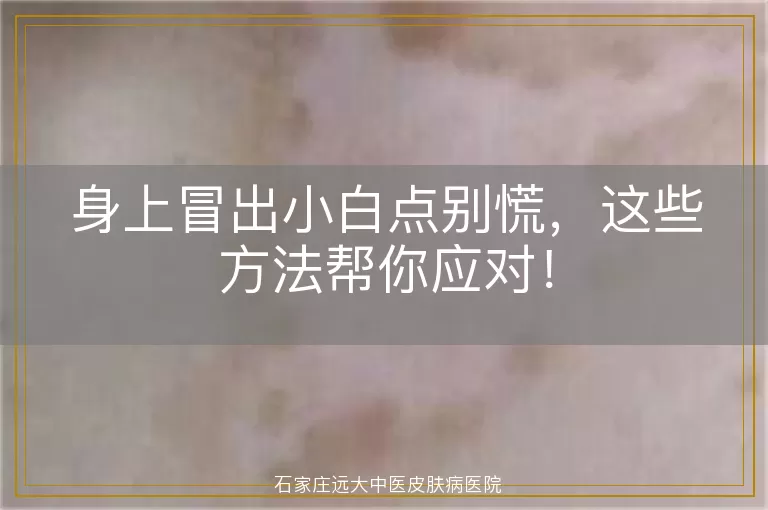 身上冒出小白点别慌，这些方法帮你应对！