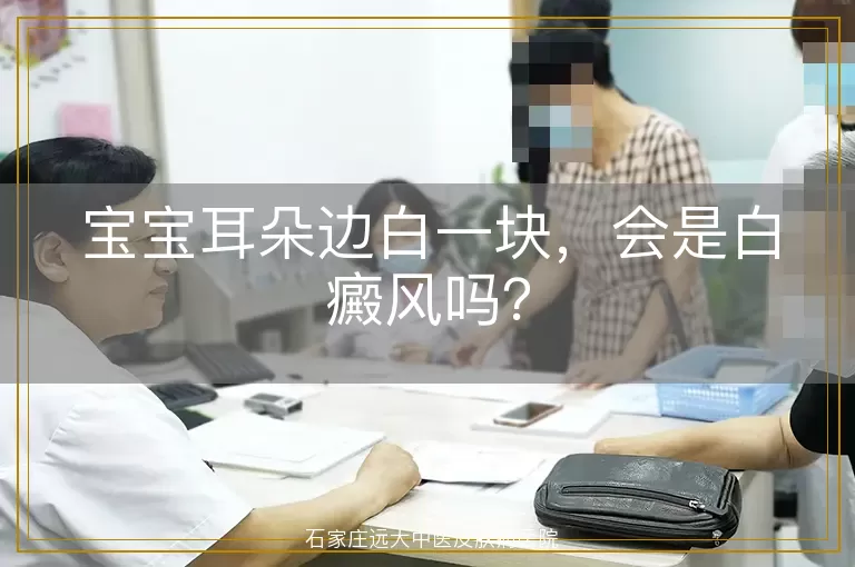 宝宝耳朵边白一块，会是白癜风吗？