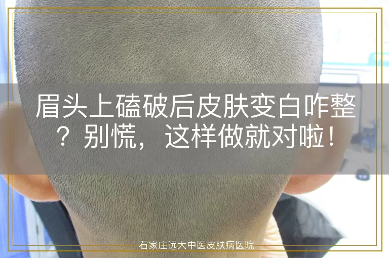 眉头上磕破后皮肤变白咋整？别慌，这样做就对啦！