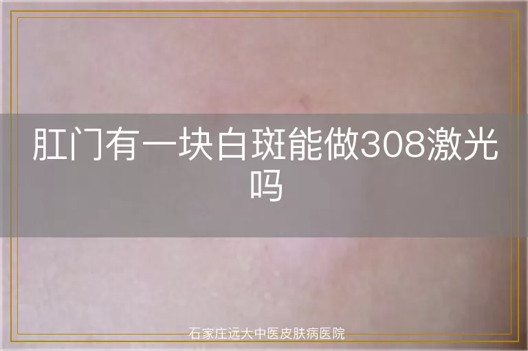 肛门有一块白斑能做308激光吗
