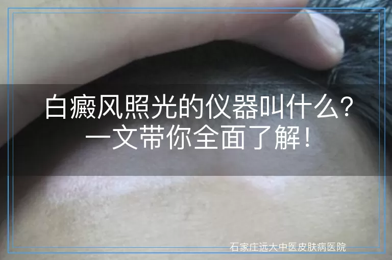 白癜风照光的仪器叫什么？一文带你全面了解！