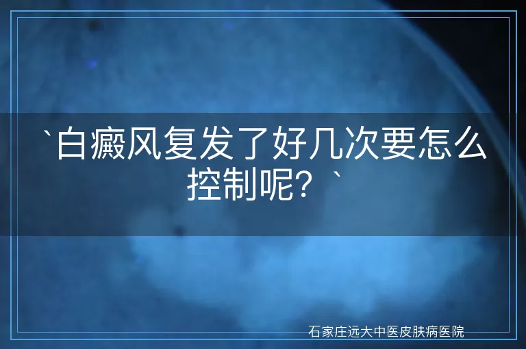 白癜风复发了好几次要怎么控制呢？