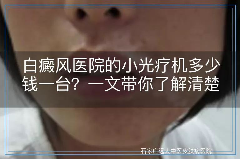 白癜风医院的小光疗机多少钱一台？一文带你了解清楚！
