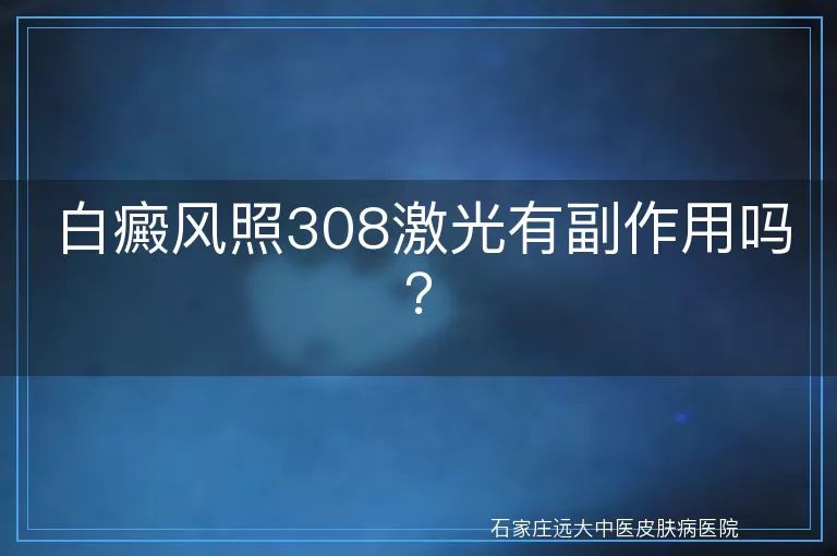 白癜风照308激光有副作用吗？