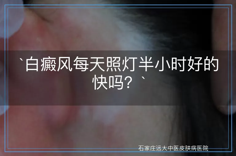白癜风每天照灯半小时好的快吗？
