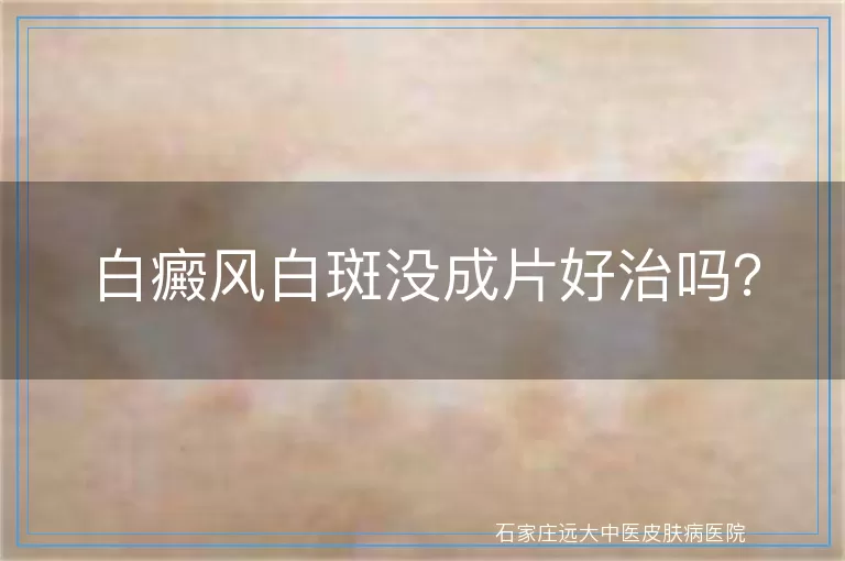 白癜风白斑没成片好治吗？