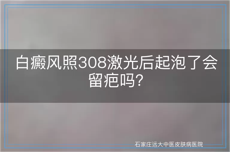 白癜风照308激光后起泡了会留疤吗？