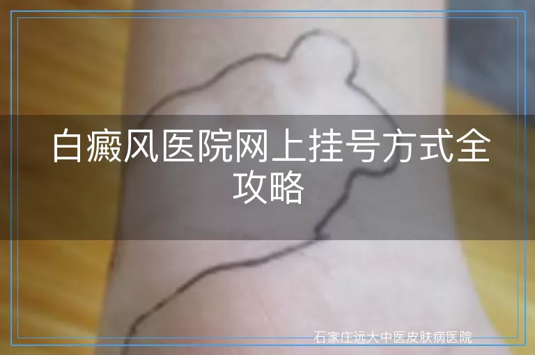 白癜风医院网上挂号方式全攻略