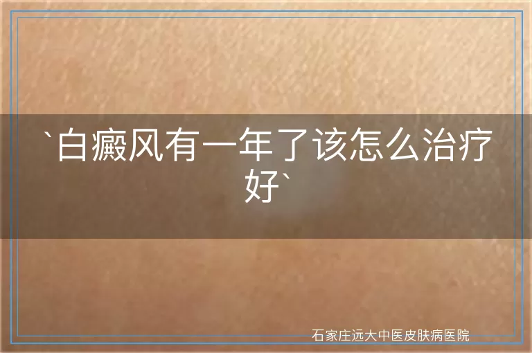 白癜风有一年了该怎么治疗好