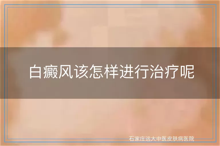 白癜风该怎样进行治疗呢