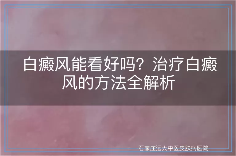 白癜风能看好吗？治疗白癜风的方法全解析