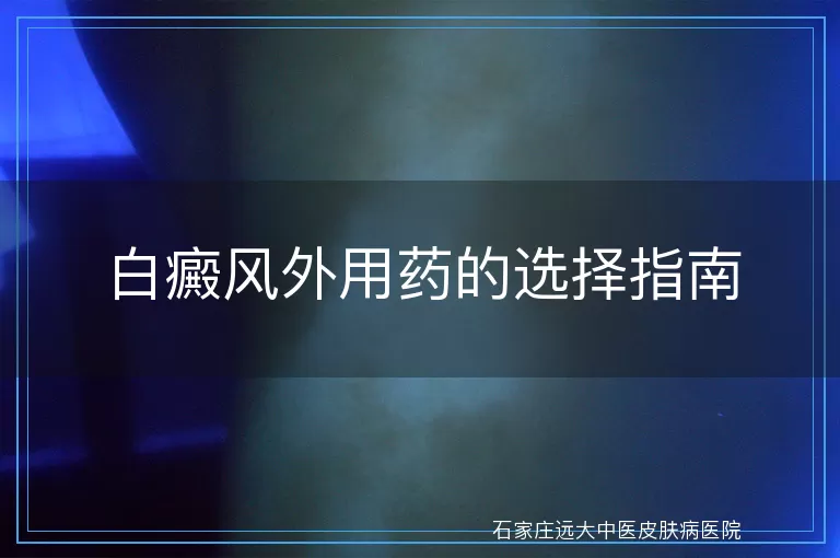 白癜风外用药的选择指南