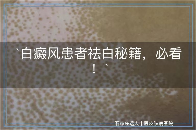 白癜风患者祛白秘籍，必看！