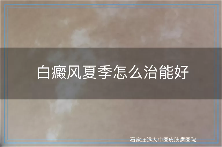 白癜风夏季怎么治能好