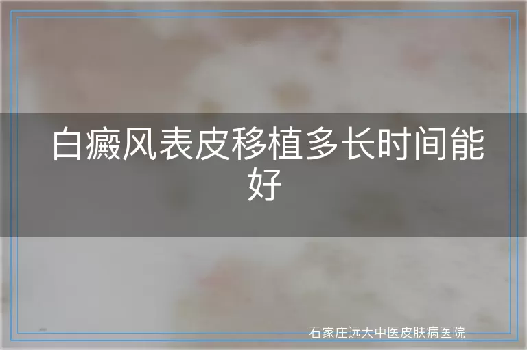 白癜风表皮移植多长时间能好