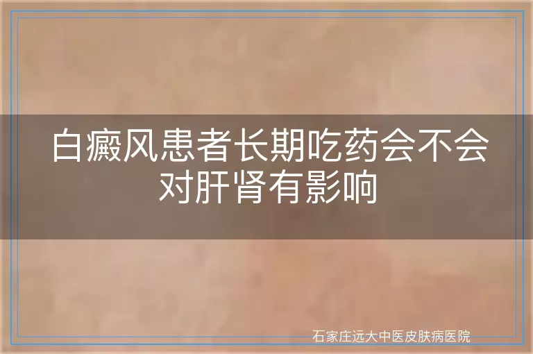 白癜风患者长期吃药会不会对肝肾有影响