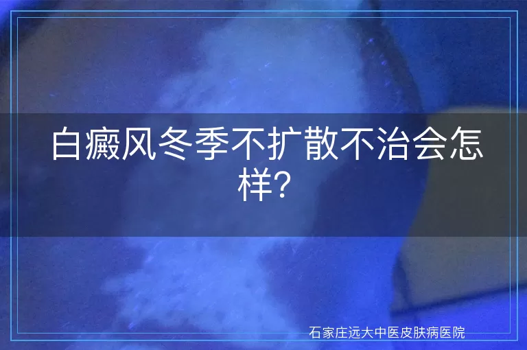 白癜风冬季不扩散不治会怎样？
