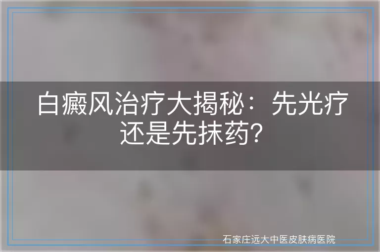 白癜风治疗大揭秘：先光疗还是先抹药？