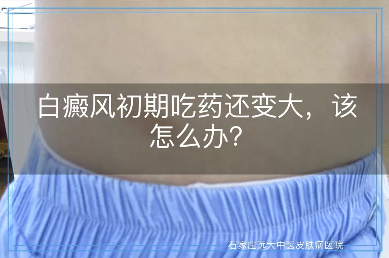 白癜风初期吃药还变大,该怎么办?