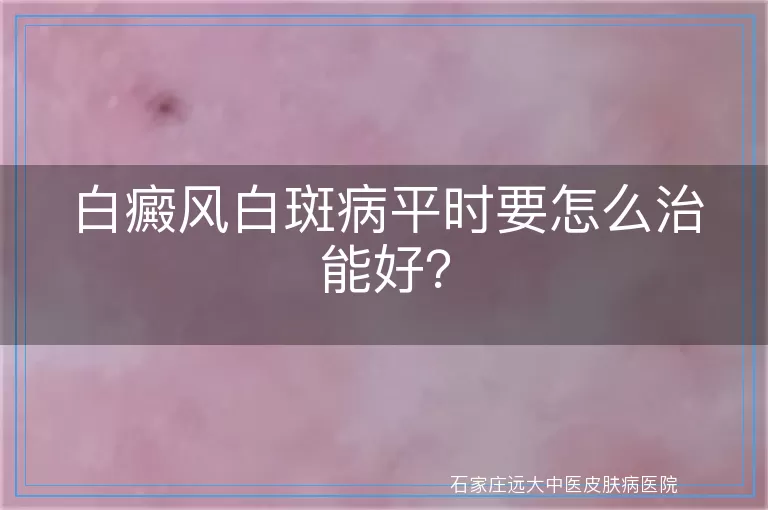白癜风白斑病平时要怎么治能好？