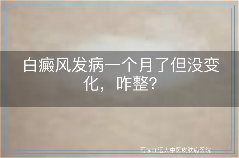 白癜风发病一个月了但没变化，咋整？