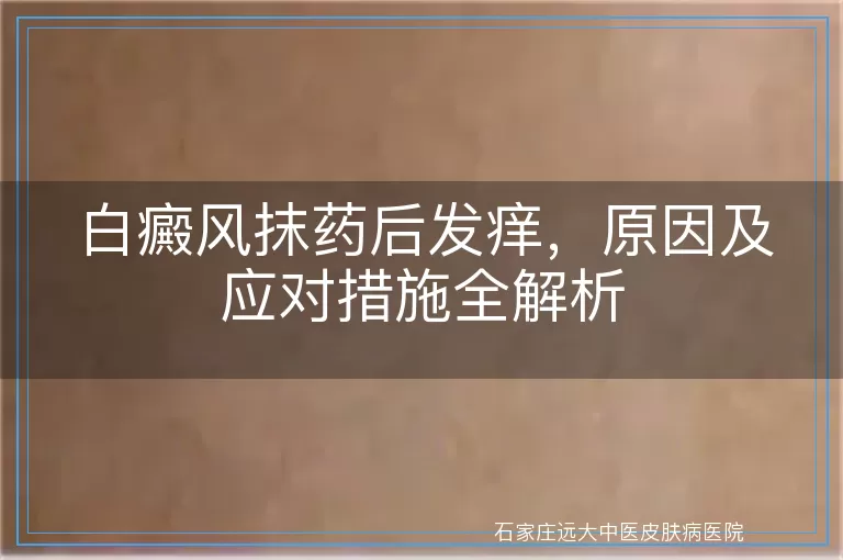 白癜风抹药后发痒，原因及应对措施全解析