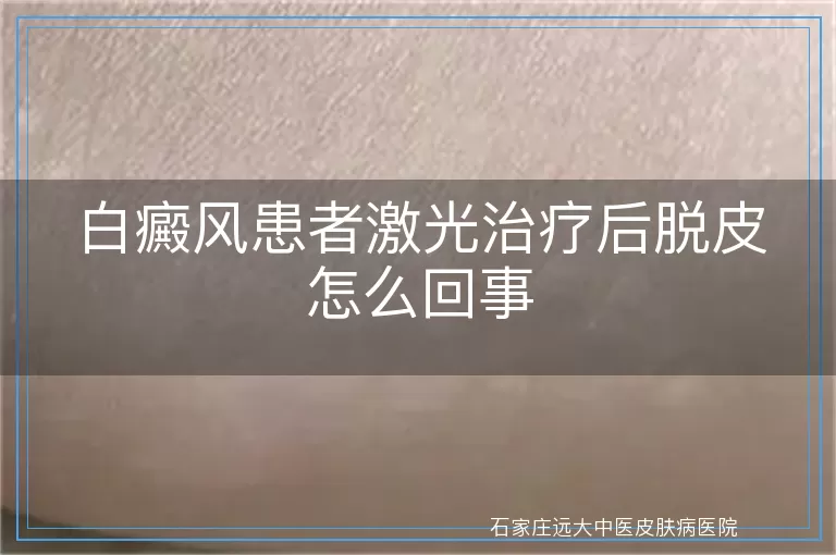 白癜风患者激光治疗后脱皮怎么回事
