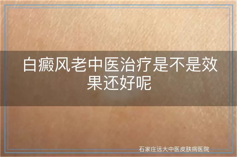 白癜风老中医治疗是不是效果还好呢