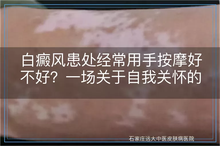白癜风患处经常用手按摩好不好？一场关于自我关怀的探讨