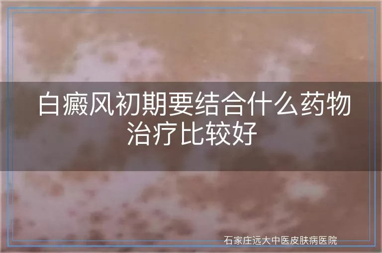 白癜风初期要结合什么药物治疗比较好