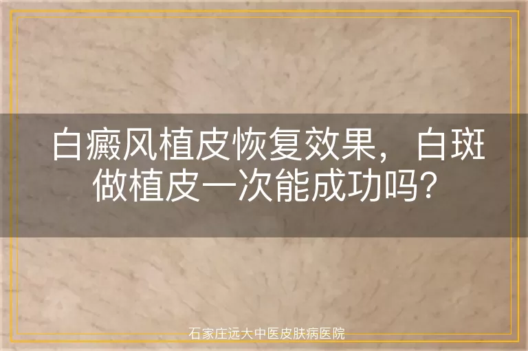 白癜风植皮恢复效果，白斑做植皮一次能成功吗？