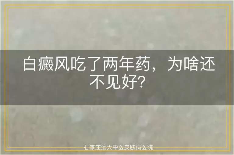 白癜风吃了两年药，为啥还不见好？