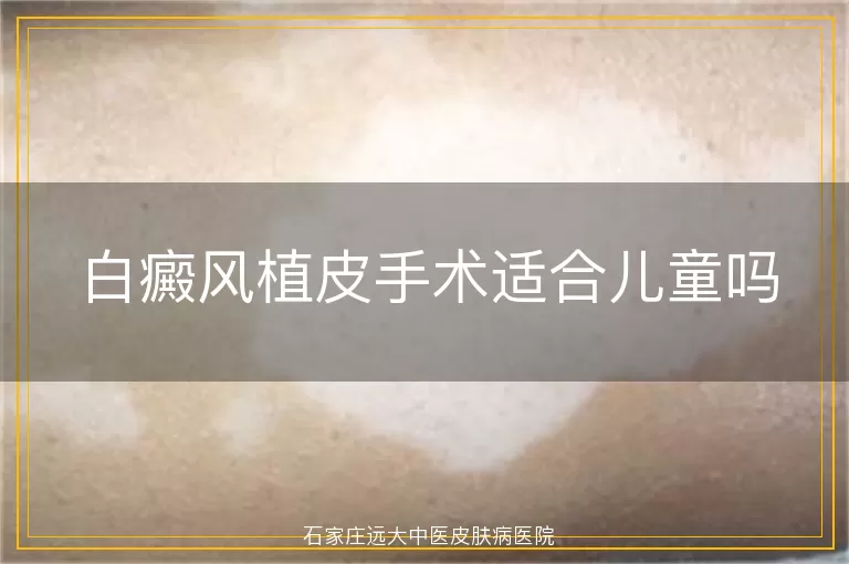 白癜风植皮手术适合儿童吗