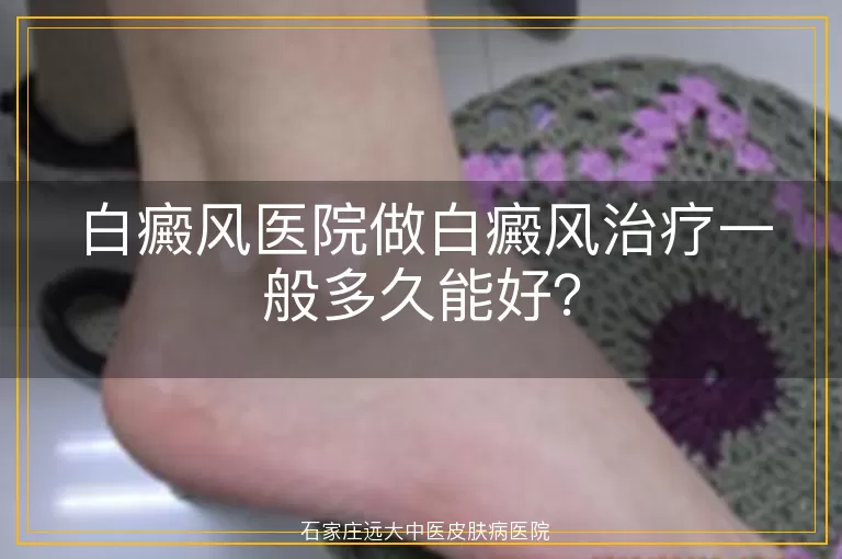 白癜风医院做白癜风治疗一般多久能好？