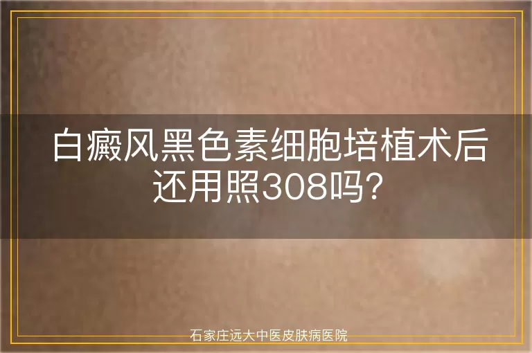 白癜风黑色素细胞培植术后还用照308吗？