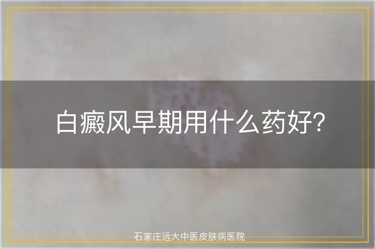 白癜风早期用什么药好？