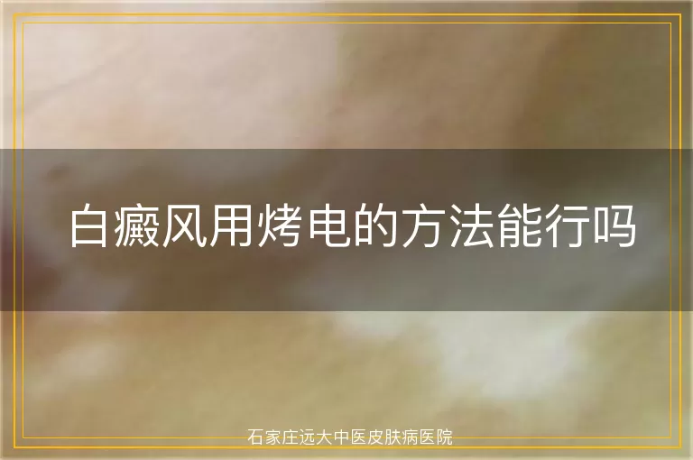 白癜风用烤电的方法能行吗
