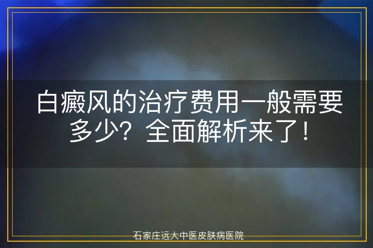 白癜风的治疗费用一般需要多少？全面解析来了！
