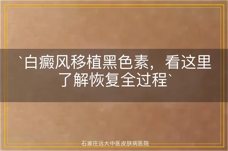 白癜风移植黑色素，看这里了解恢复全过程