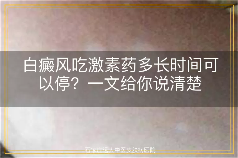 白癜风吃激素药多长时间可以停？一文给你说清楚