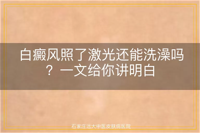 白癜风照了激光还能洗澡吗？一文给你讲明白