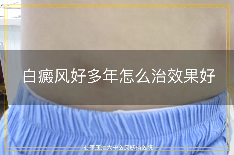 白癜风好多年怎么治效果好