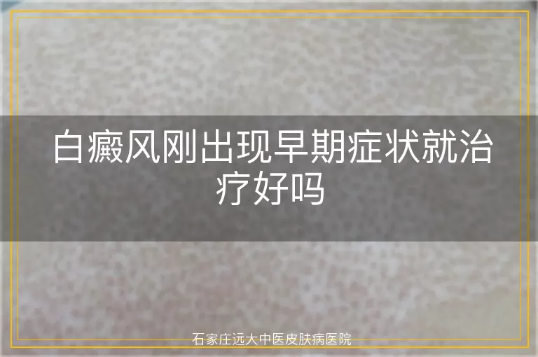 白癜风刚出现早期症状就治疗好吗