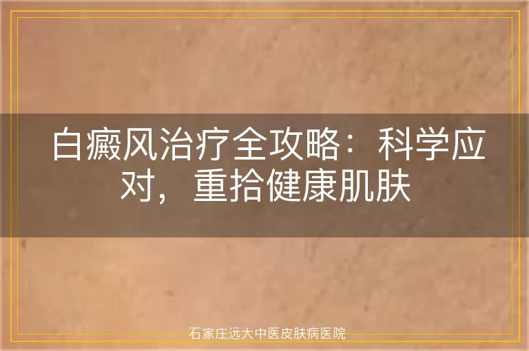白癜风治疗全攻略：科学应对，重拾健康肌肤