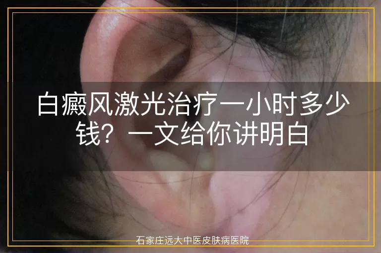 白癜风激光治疗一小时多少钱？一文给你讲明白